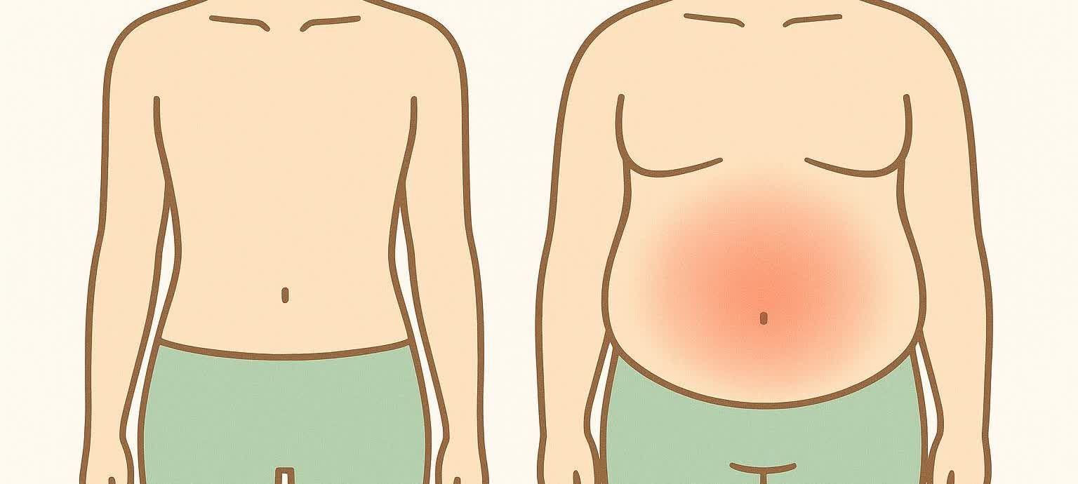 Stylized comparison of a healthy torso silhouette versus one with central fat accumulation.