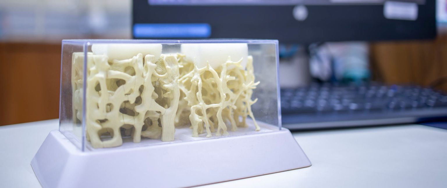 A clear plastic model of bone structure sits on a white surface with a blurry computer monitor and keyboard in the background.
