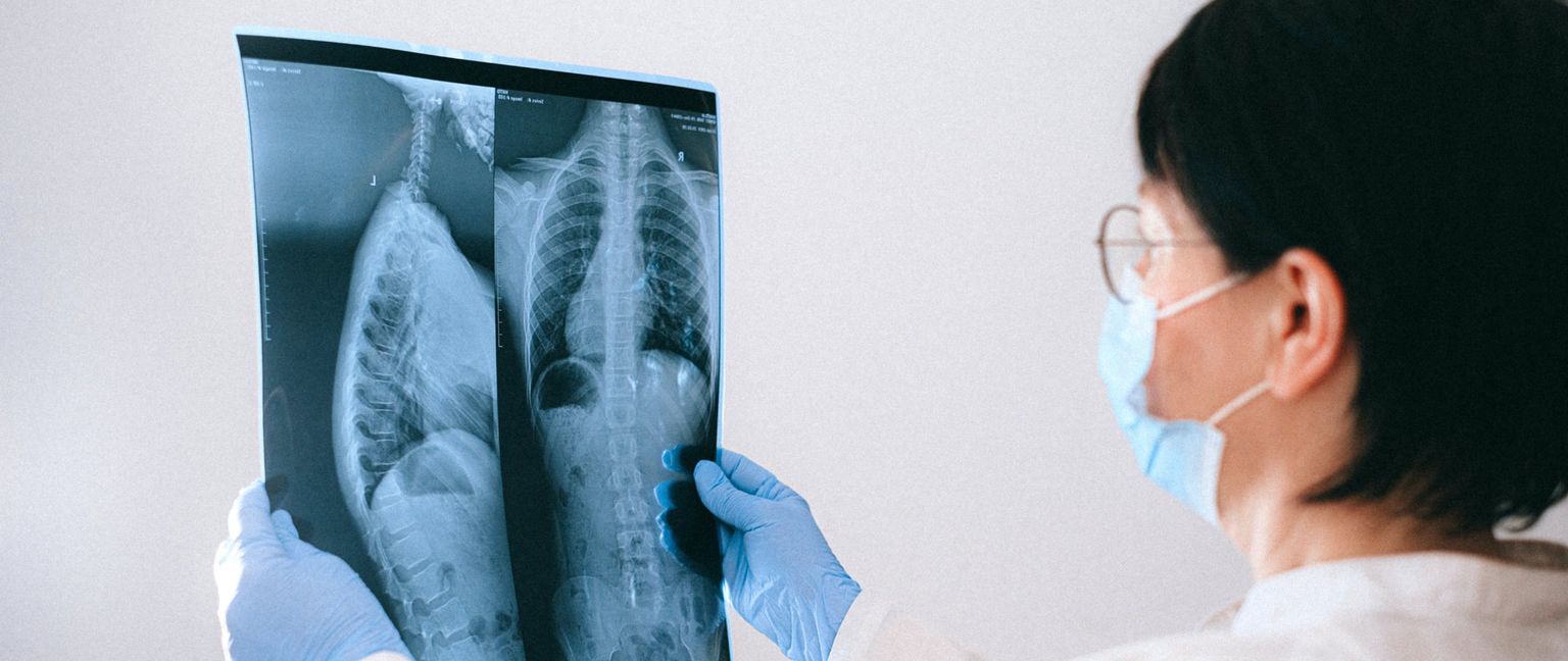 A healthcare professional wearing a mask and gloves examines chest and spine X-rays.
