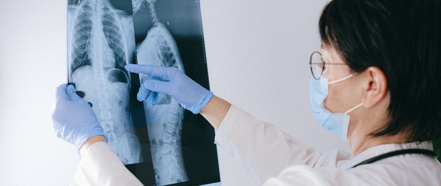 A doctor wearing gloves and a mask examines an X-ray of a spine, pointing at a specific area.