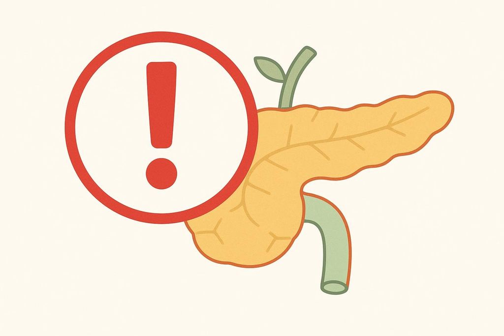 An illustration depicting a yellow pancreas with a red warning-exclamation mark icon overlay, signifying the risk of pancreatitis or pancreatic issues.